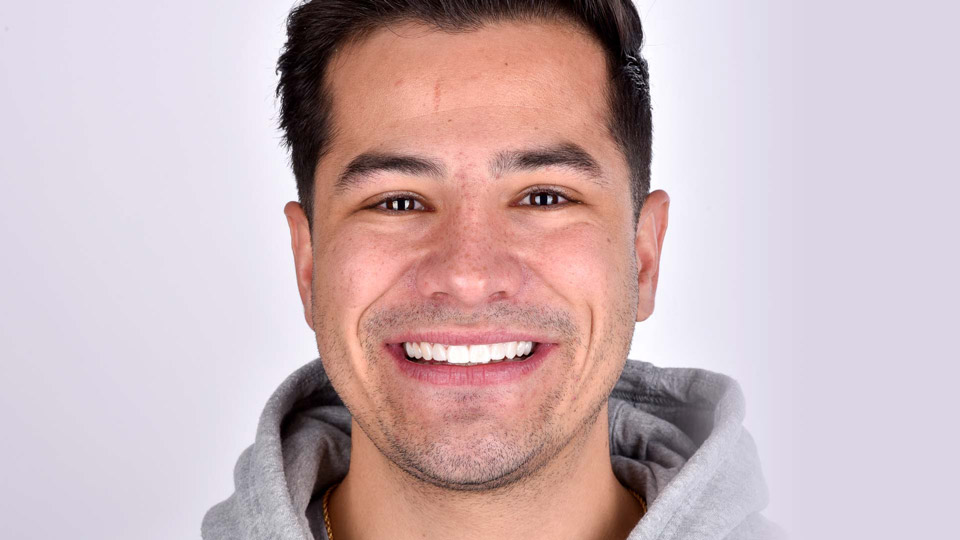 A young man smiling to show his teeth after his dental treatment with Digital Smile Design