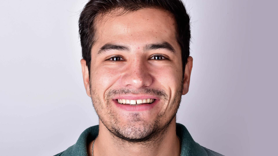 A young man smiling to show his teeth before dental treatment with Digital Smile Design
