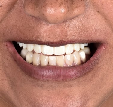 Dental_Implants_Main_Page_Gallery_01