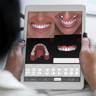 A patient looking at the design of their new smile on the Digital Smile Design app