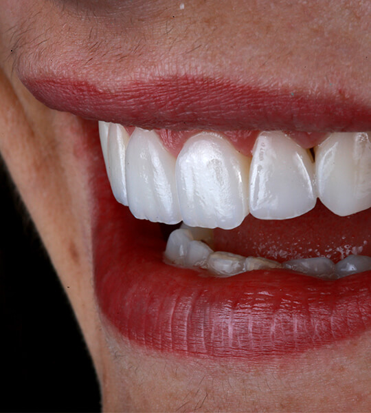 A close up of natural-looking teeth