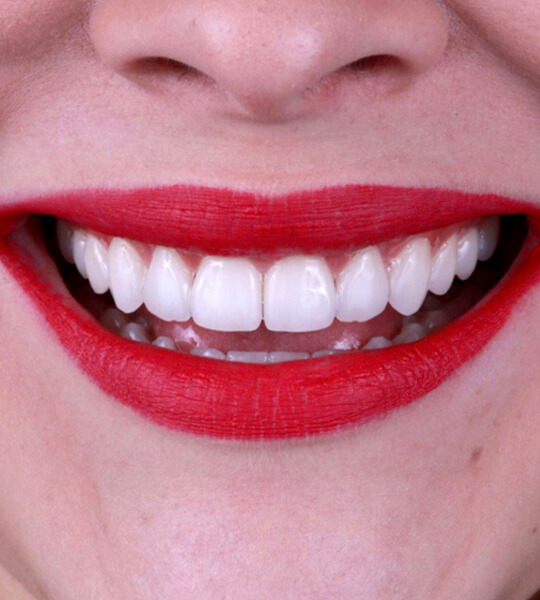 A close up of natural-looking teeth