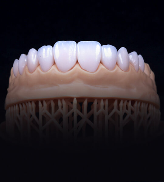 A printed model of a patient’s smile design