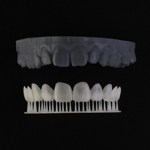 A model of the patient’s current smile and a 3D printed model of the new smile design which can be tried on over his own teeth